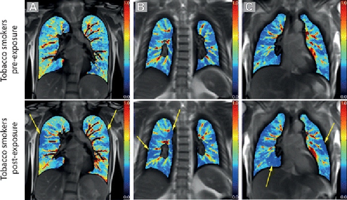 fmri smokers