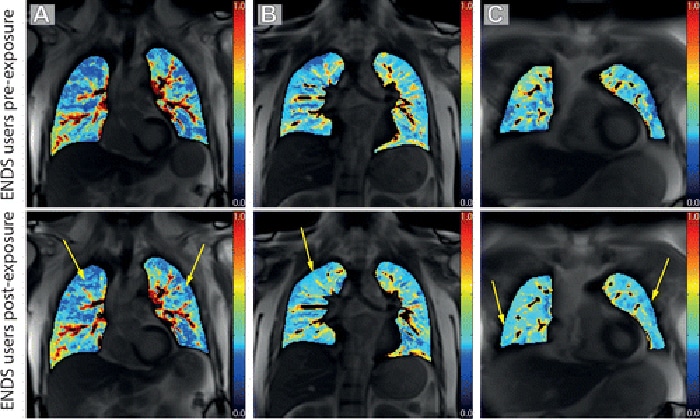 fmri vapers